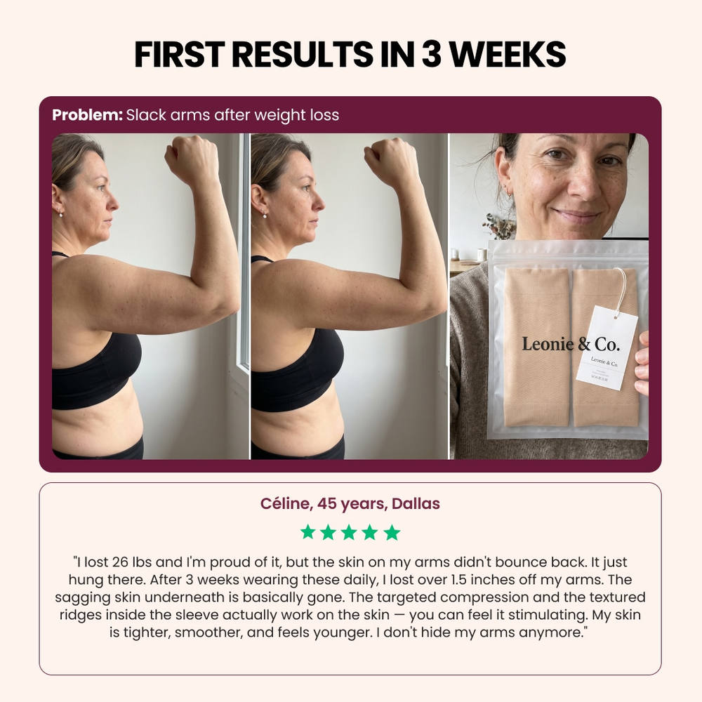Before and after photo of a customer's upper arms wearing the Leonie Leggings arm sleeves, with her five-star review