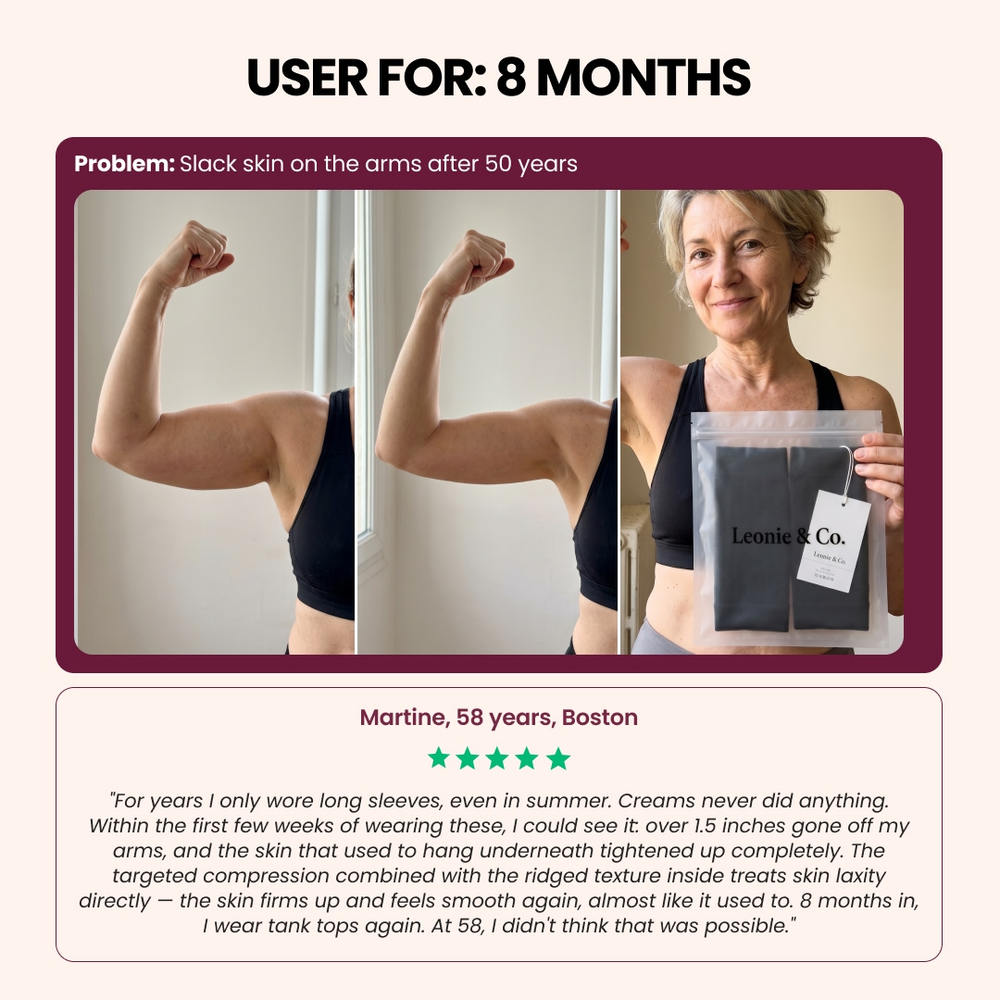 Before and after photo of a customer's upper arms wearing the Leonie Leggings arm sleeves, with her five-star review